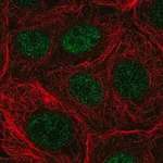 Merck Anti-NUDT22 antibody produced in rabbit