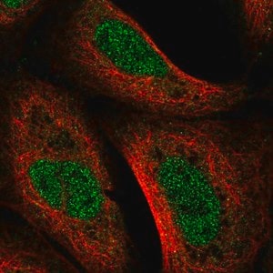 Merck Anti-UVSSA antibody produced in rabbit