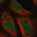 Merck Anti-UVSSA antibody produced in rabbit