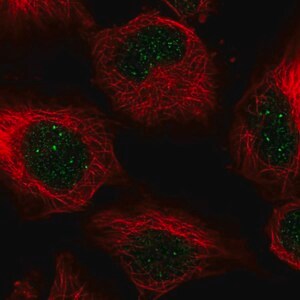 Merck Anti-CENPB antibody produced in rabbit