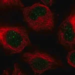 Merck Anti-CENPB antibody produced in rabbit