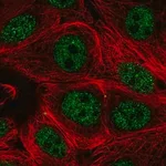 Merck Anti-PCNX1 antibody produced in rabbit