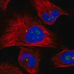 Merck Anti-CLHC1 antibody produced in rabbit