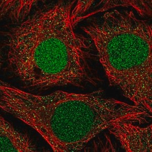 Merck Anti-NFATC2IP antibody produced in rabbit