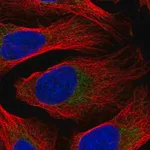 Merck Anti-DDX28 antibody produced in rabbit