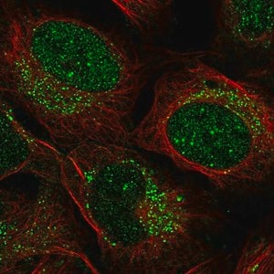 Merck Anti-ZADH2 antibody produced in rabbit