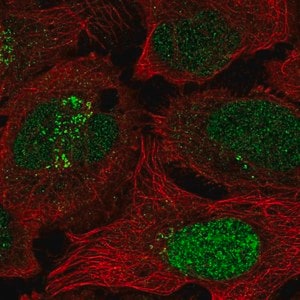 Merck Anti-ESCO2 antibody produced in rabbit