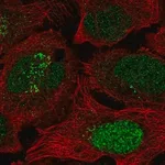 Merck Anti-ESCO2 antibody produced in rabbit
