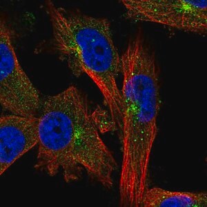 Merck Anti-EVI5 antibody produced in rabbit