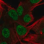Merck Anti-HTR2B antibody produced in rabbit