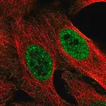 Merck Anti-MED22 antibody produced in rabbit