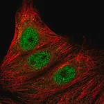 Merck Anti-ARMC5 antibody produced in rabbit