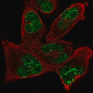 Merck Anti-ANKRD17 antibody produced in rabbit