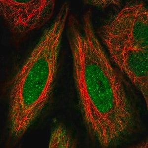 Merck Anti-FANCD2 antibody produced in rabbit
