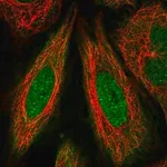 Merck Anti-FANCD2 antibody produced in rabbit