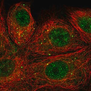 Merck Anti-SEMA3E antibody produced in rabbit