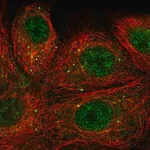 Merck Anti-SEMA3E antibody produced in rabbit