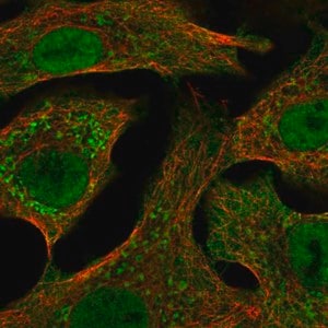 Merck Anti-CYP24A1 antibody produced in rabbit