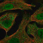 Merck Anti-CYP24A1 antibody produced in rabbit