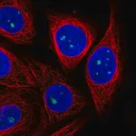 Merck Anti-ZDHHC14 antibody produced in rabbit