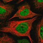 Merck Anti-BAZ2A antibody produced in rabbit