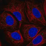 Merck Anti-HTRA3 antibody produced in rabbit