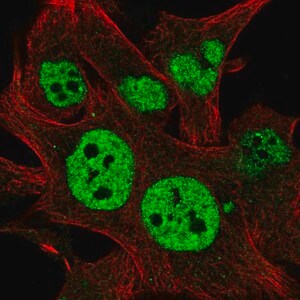 Merck Anti-TESK2 antibody produced in rabbit