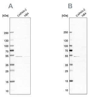 Merck Anti-SPTLC1 antibody produced in rabbit