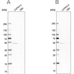 Merck Anti-SPTLC1 antibody produced in rabbit