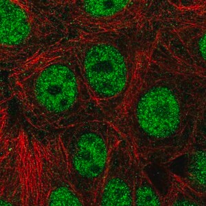 Merck Anti-ZNF335 antibody produced in rabbit