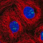 Merck Anti-NOC3L antibody produced in rabbit