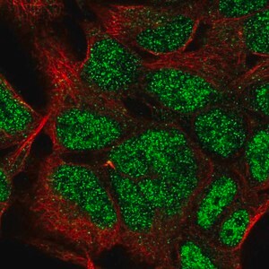 Merck Anti-HOXC9 antibody produced in rabbit