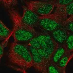 Merck Anti-HOXC9 antibody produced in rabbit