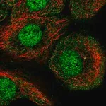 Merck Anti-AKNA antibody produced in rabbit