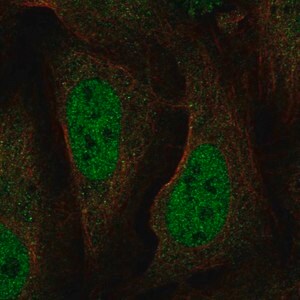 Merck Anti-BRAT1 antibody produced in rabbit