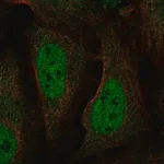 Merck Anti-BRAT1 antibody produced in rabbit