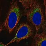 Merck Anti-DEGS1 antibody produced in rabbit