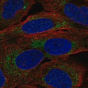 Merck Anti-A4GALT antibody produced in rabbit