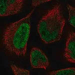 Merck Anti-LCOR antibody produced in rabbit