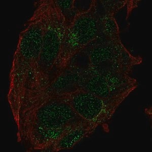 Merck Anti-USP27X antibody produced in rabbit
