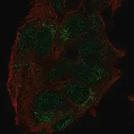 Merck Anti-USP27X antibody produced in rabbit