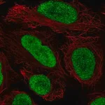 Merck Anti-HMGN2 antibody produced in rabbit