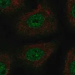 Merck Anti-TSC22D1 antibody produced in rabbit