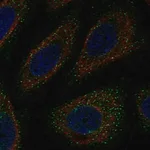Merck Anti-WNK3 antibody produced in rabbit