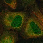 Merck Anti-CSNK2A2 antibody produced in rabbit
