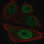 Merck Anti-ETV1 antibody produced in rabbit