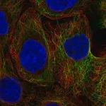 Merck Anti-KRT80 antibody produced in rabbit