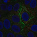 Merck Anti-ADCY5 antibody produced in rabbit