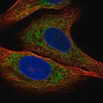 Merck Anti-IGFBP2 antibody produced in rabbit