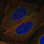 Merck Anti-CNEP1R1 antibody produced in rabbit